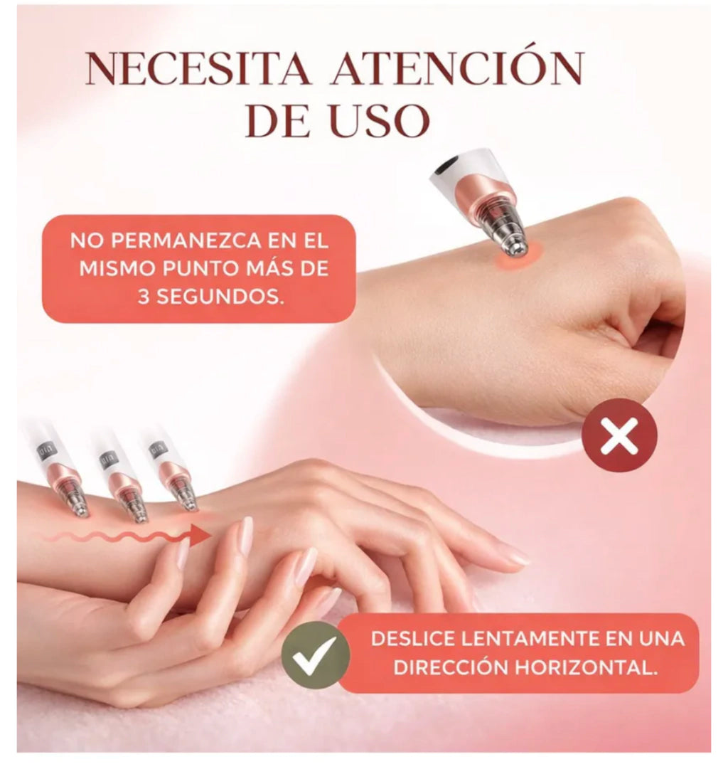 Removedor Extractor Puntos Negros Recargable 5 Cabezales
